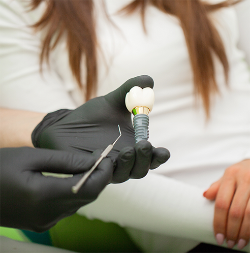 Gloved hand holding model of dental implant