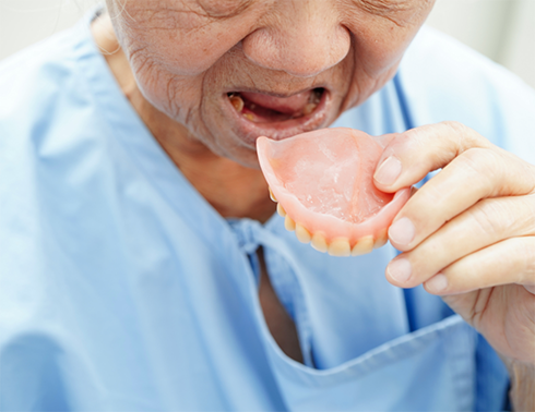 Older man taking out full dentures