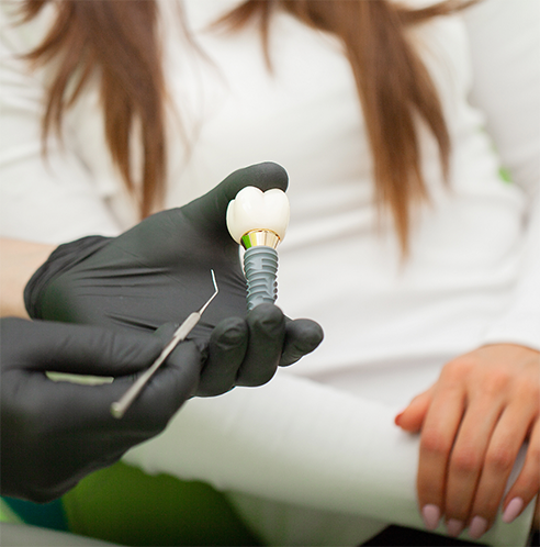 Gloved hand holding a dental implant post