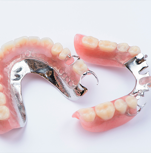 Close up of partial dentures