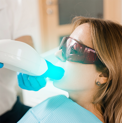 Female patient with protective eyewear having teeth whitened