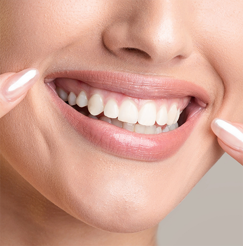 Close up of woman pointing to her smile