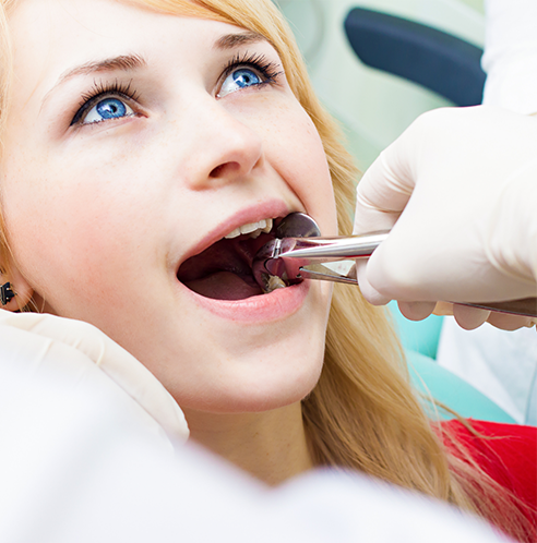 Woman holding mouth open for wisdom tooth extraction in Midland