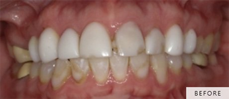 Smile with gap between front teeth